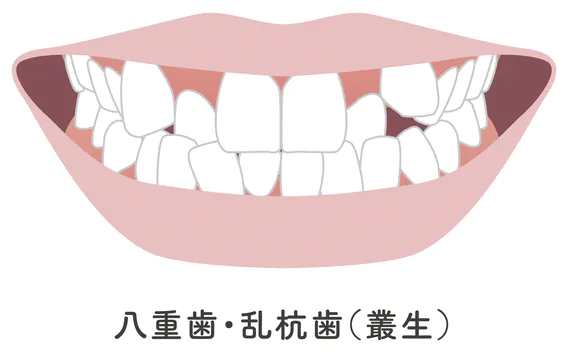 部分矯正に向いている症状：