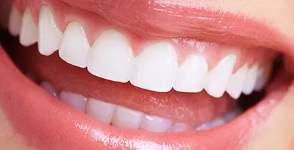銀歯やすきっ歯の改善　セラミック治療